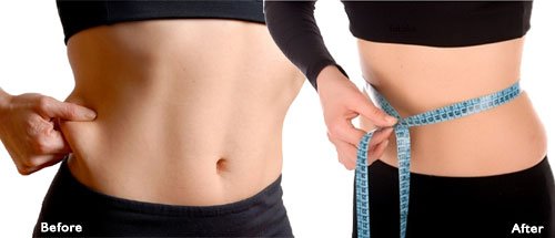 Liposuction Pakistan